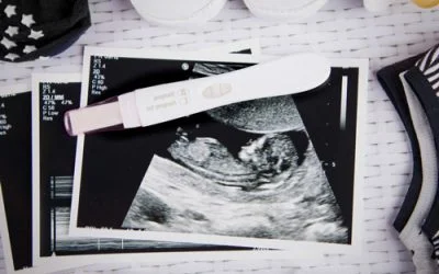 How My Unplanned Pregnancy Changed My Life